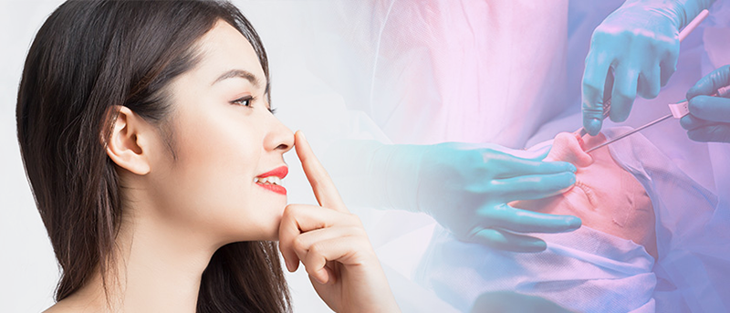 Hướng dẫn chăm sóc sau khi nâng mũi Softline 4D